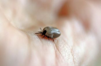a tick on someone's hand
